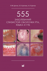 555 заболеваний слизистой оболочки рта, языка и губ.
