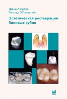 Эстетическая реставрация боковых зубов. Вкладки и накладки